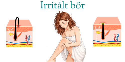 Irritált bőr